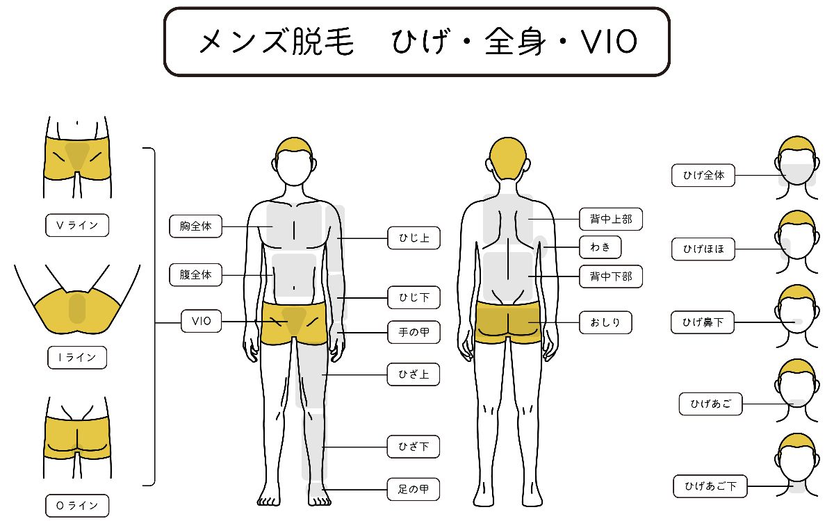 図