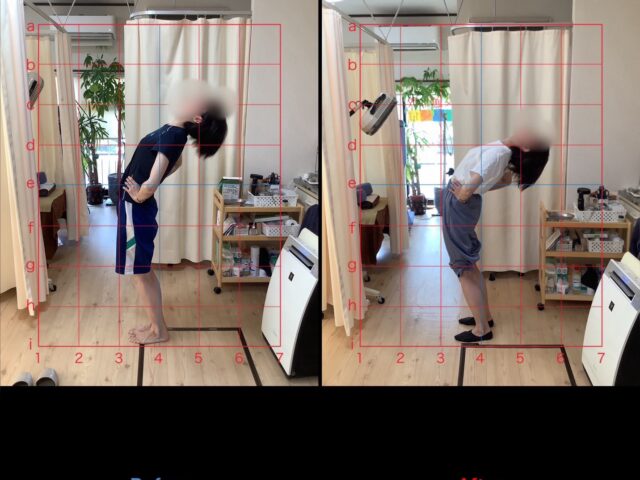 堺市 美原区｜姿勢改善整体で膝・股関節痛と外反母趾を改善