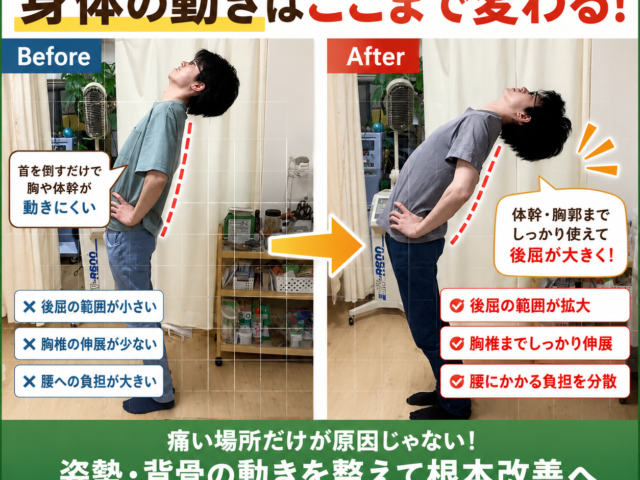 腰痛・肩こりを繰り返す原因は背骨の硬さ？整体による姿勢改善｜堺市美原